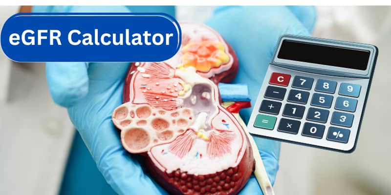 what is a EGFR Calculator